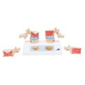 Osteoporosis Model