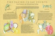Sacro-iliac Joint Poster