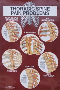 Thoracic Spine Diagnosis