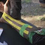 Sports chiropractic team, KT Tape donate $7,000 worth of Kinesiology Tape