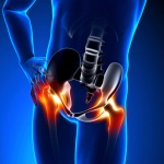 Easing hip pain on the chiropractic table