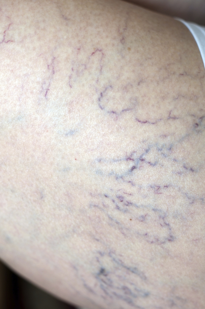 ThinkstockPhotos-179127549