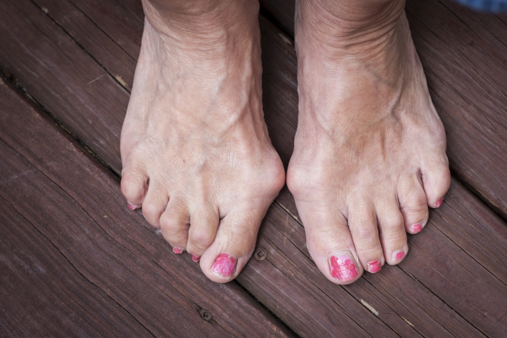 ThinkstockPhotos-500887439