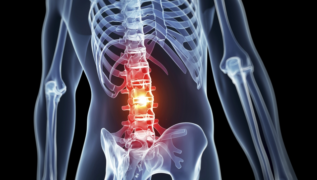back pain-470554733