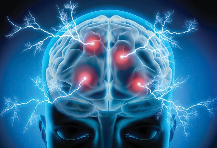How laser therapy can help mild traumatic brain injury