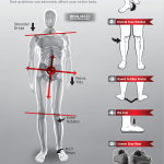 5 Red Flags of Pronation Poster