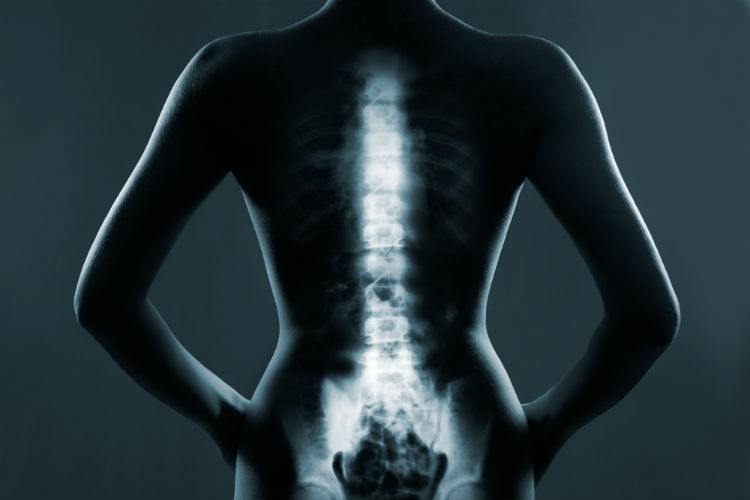 Help patients address their bad spine habits that could potentially lead to spinal issues later in life