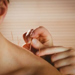 The pros and cons of adding acupuncture to your practice