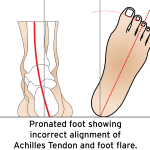 Chiropractic Economics Summer Buyers Guide: orthotics and 3D foot scanning
