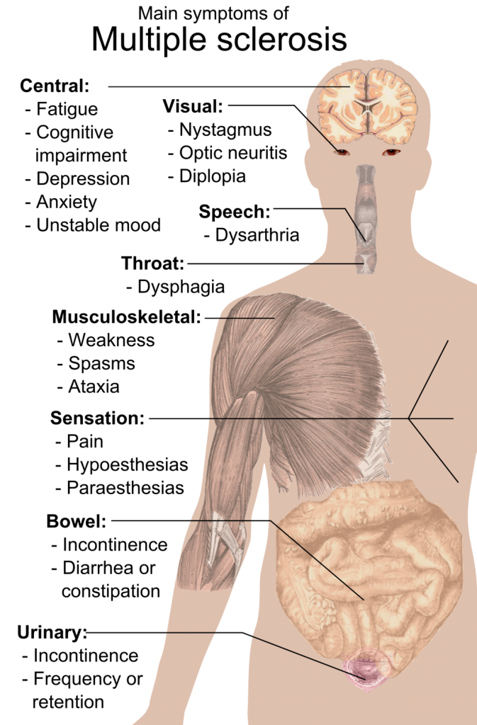 CBD for MS patients is building supporting research for the disease in which a person’s immune system attacks healthy tissues within the central nervous...