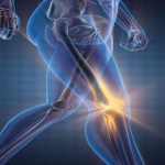 How to avoid knee surgery and prevent lower extremity injuries for patients