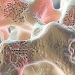 Early warning signs of osteoporosis and finding the cause