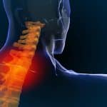 Chiropractic and the necessity of spinal X-rays