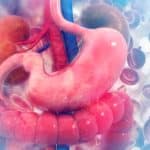 IBS, SIBO natural treatment for a healthy microbiome