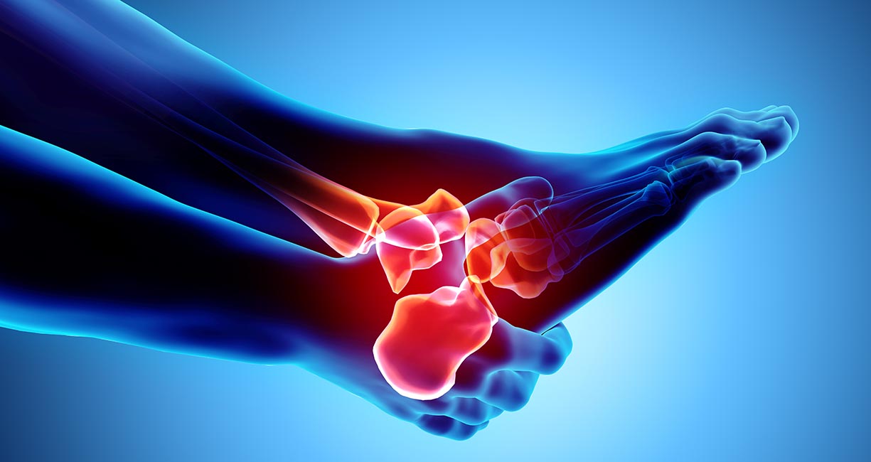 X-ray of a painful ankle