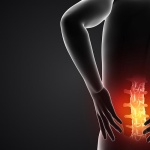 Managing low-back pain in the active person