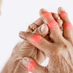 Help patients manage arthritis symptoms with diet