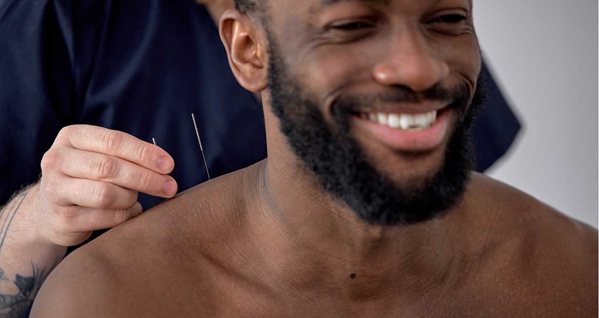 acupuncture treatment